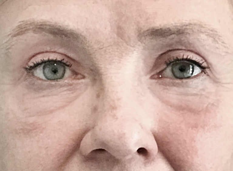 Efter