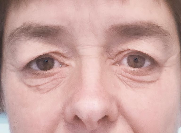 Före