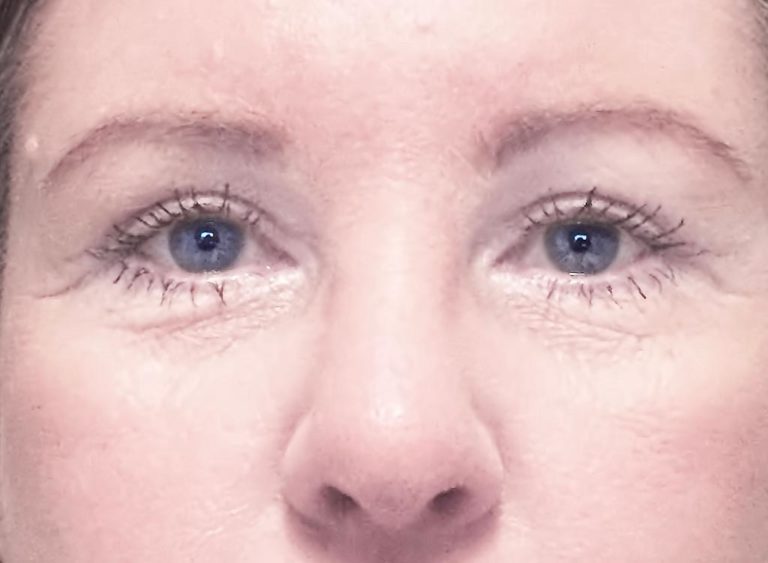 Efter