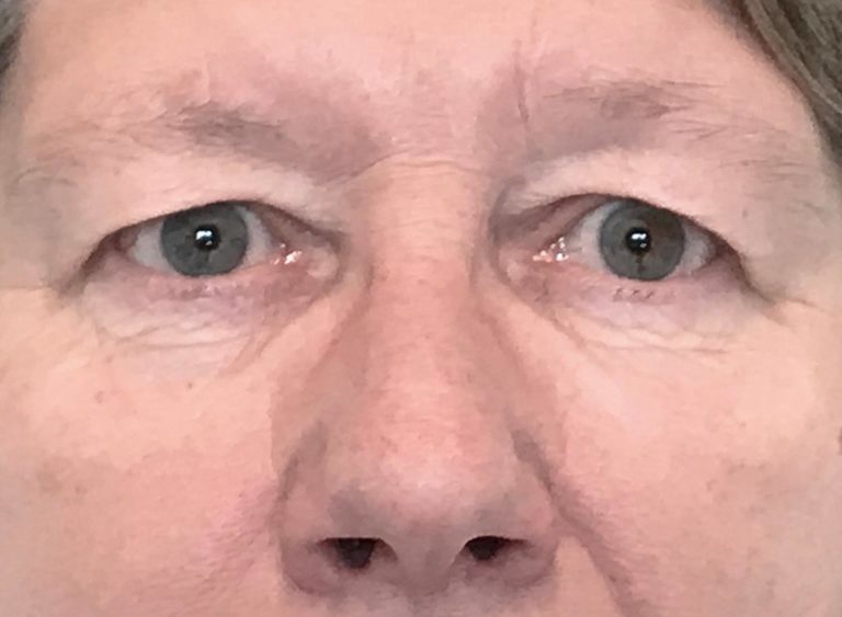 Före