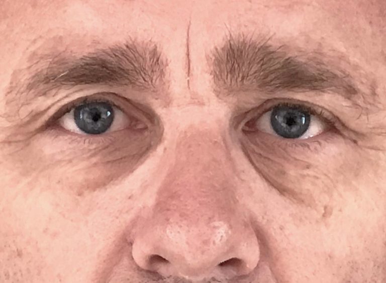 Före
