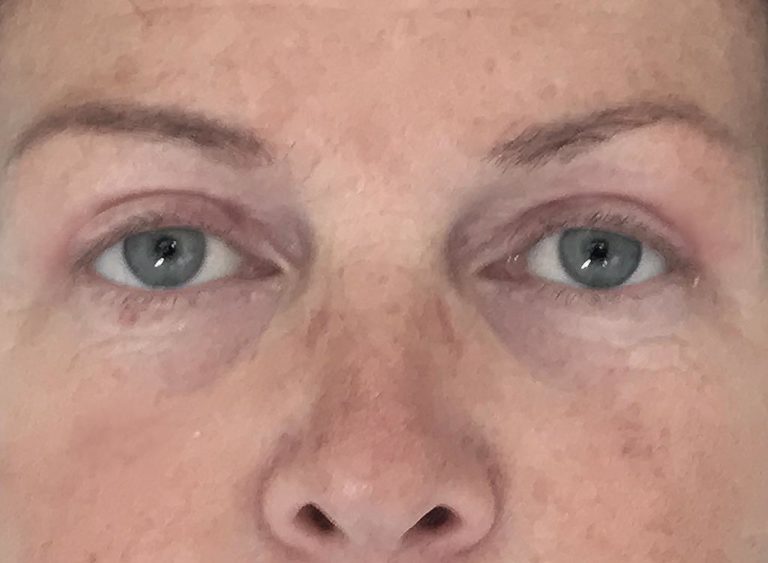 Efter