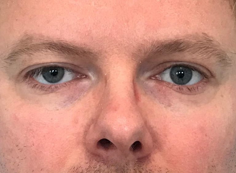 Efter