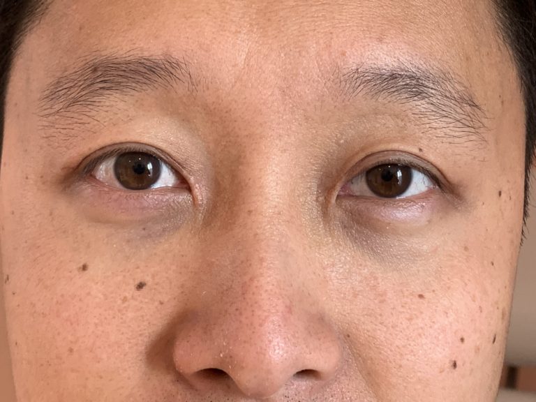 Efter Asiatiska ögon före efter